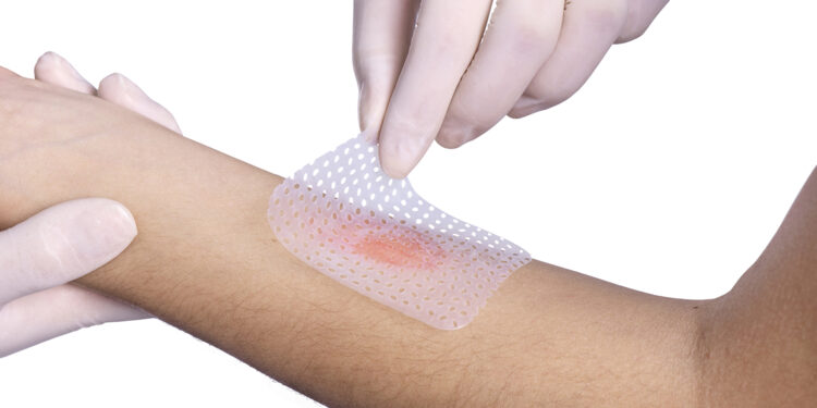 Primeiros Socorros em caso de queimadura de 2º grau Primeiros Socorros em caso de queimadura de 2º grau