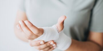 Primeiros Socorros em caso de queimadura de 1º grau