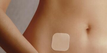 Adesivo anticoncepcional: método simples e seguro para usar