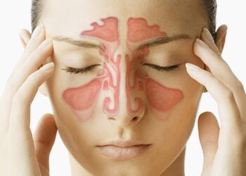 Sinusite Crônica: o que é e quais os sintomas