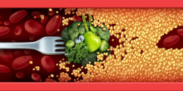 Saiba as maneiras de diminuir o colesterol ruim