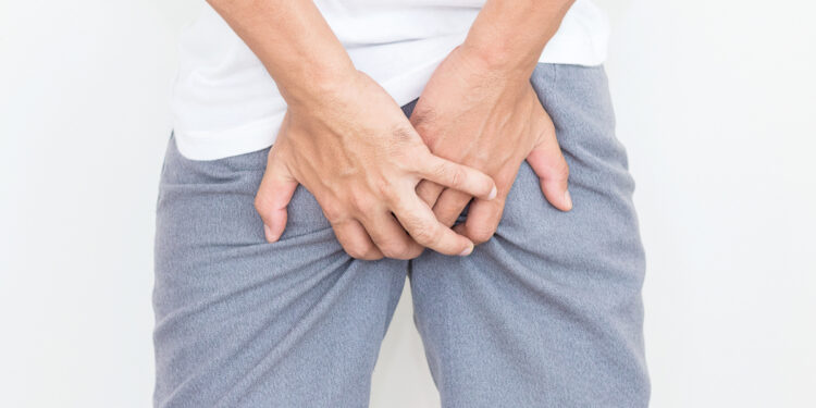 Hemorroidas: o que são, como aparecem e quais os tratamentos disponíveis